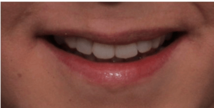 Mouth - mendelsohn dental