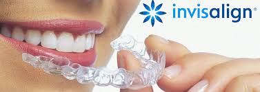 invisalign