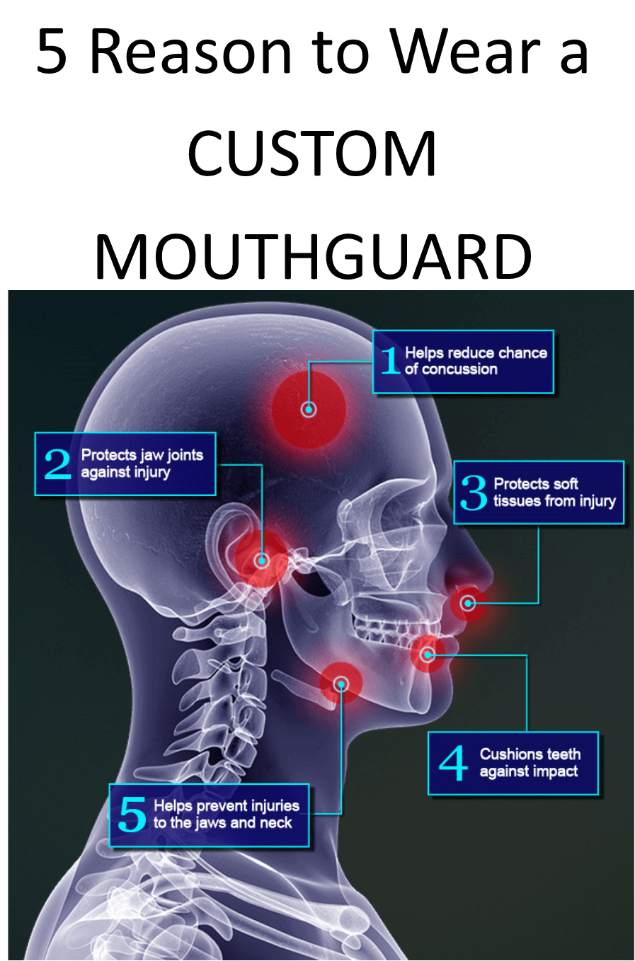 The Many Benefits of Mouth Guards: Smile Design Manhattan