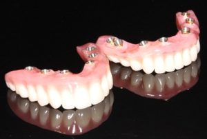 dent-imp-img-11 | Mendelsohn Dental on Royal