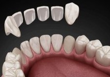 image | Mendelsohn Dental on Royal