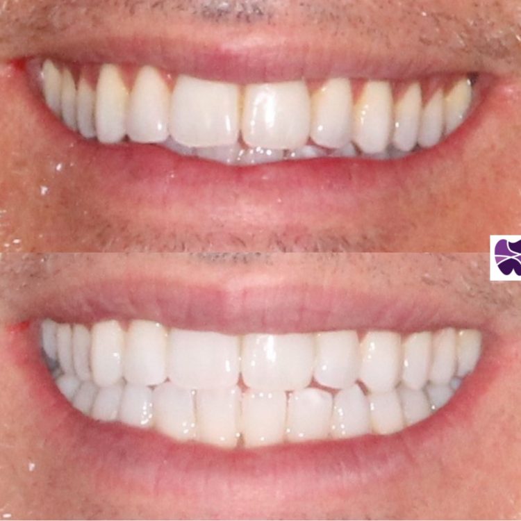 ih | Mendelsohn Dental on Royal