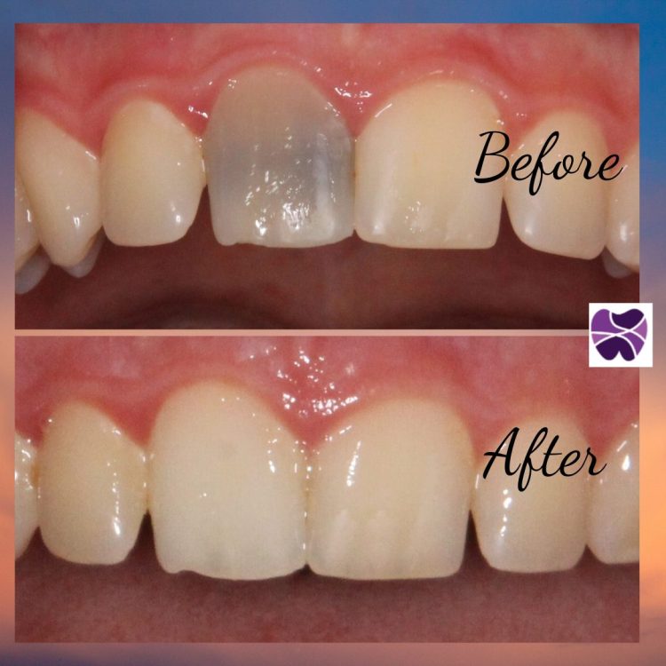 internal | Mendelsohn Dental on Royal